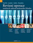 Obálka knihy Revizní operace totálních náhrad kolenního kloubu